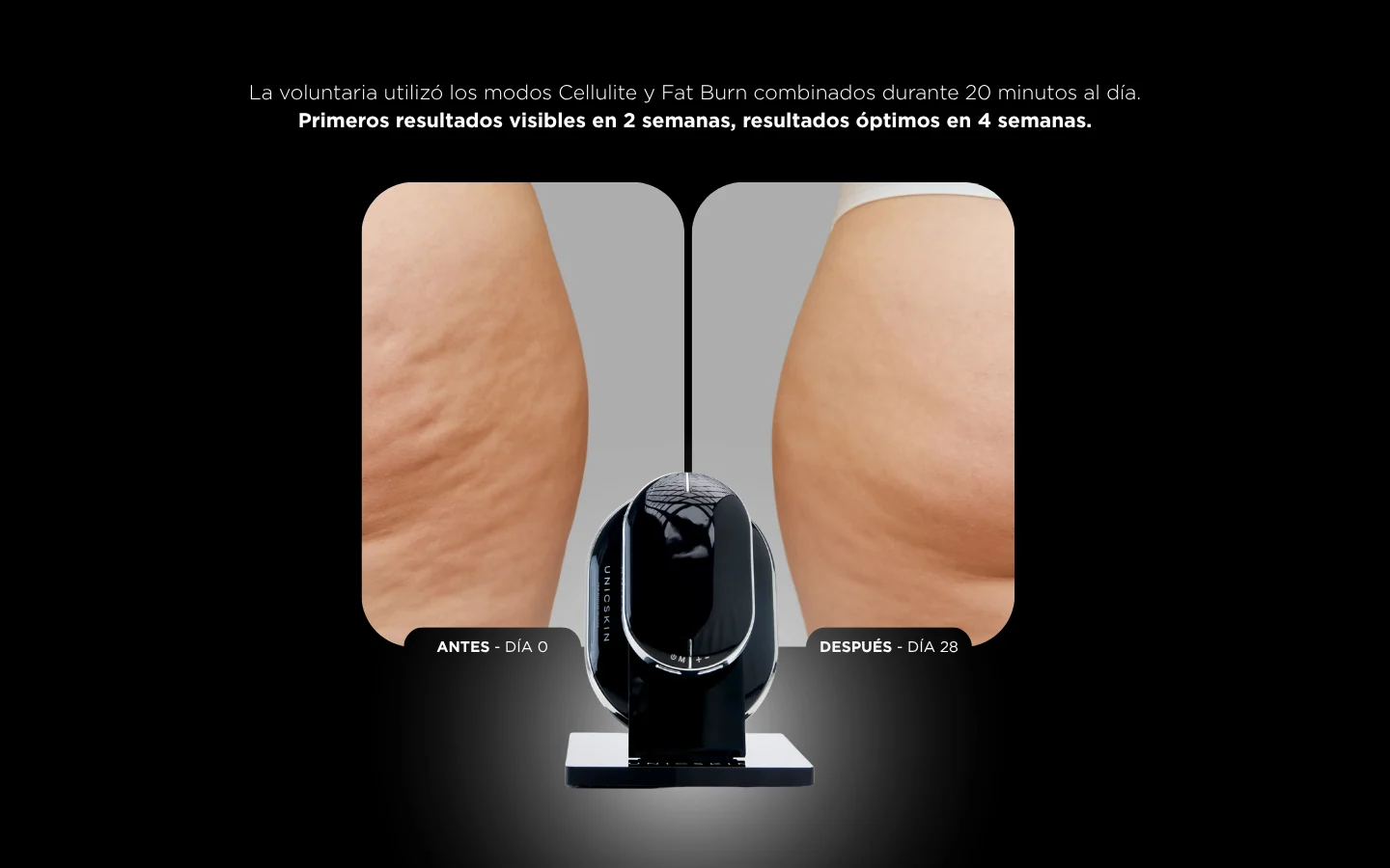 UNICTECH BODY SLIM x4